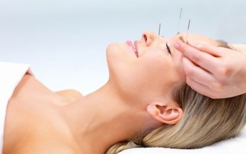 Image for Wat is acupunctuur